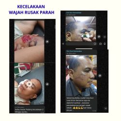 KECELAKAAN - WAJAH RUSAK