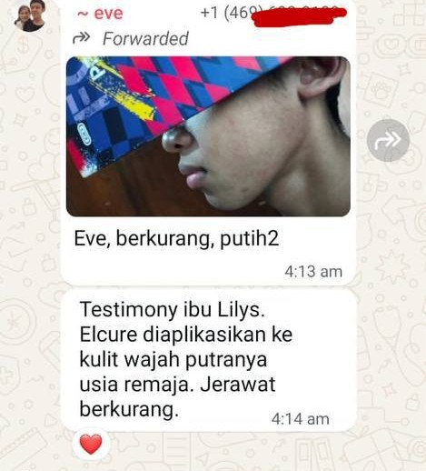 jerawat
