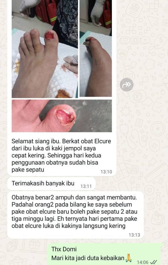 luka cepat kering