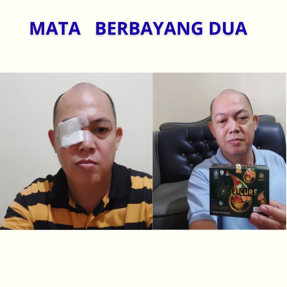mata berbayang 2